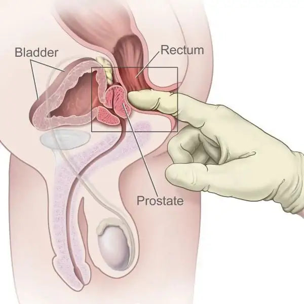 Prostate Massager - Frisky Business Adult Sex Toys Shop