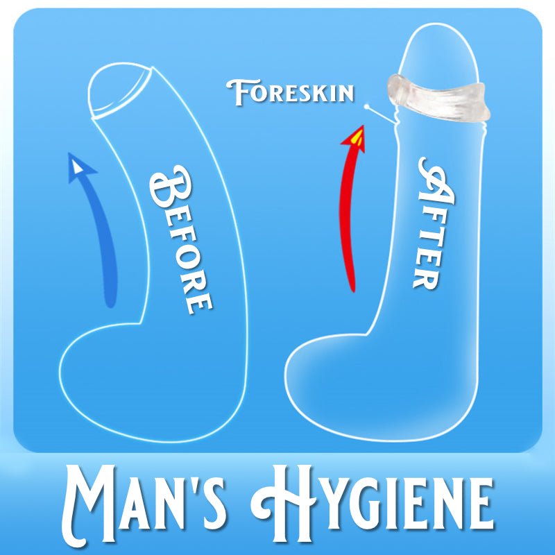 Cock C-Ring - Foreskin Correction Device - FRISKY BUSINESS SG